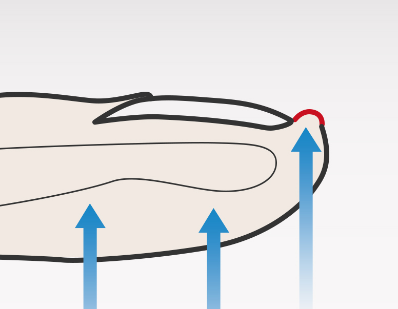 深爪が及ぼす影響
